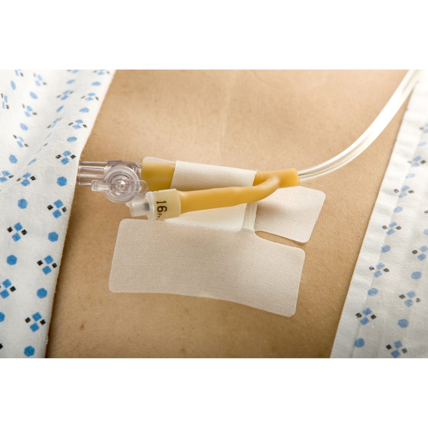 Cath-Secure™ Holder, Tube 5445-2