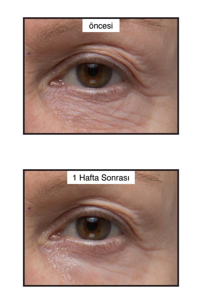 Murad Renewing Eye Cream 15ml - Anti-Aging Moisturizing Eye Cream for Fine Lines & Wrinkles