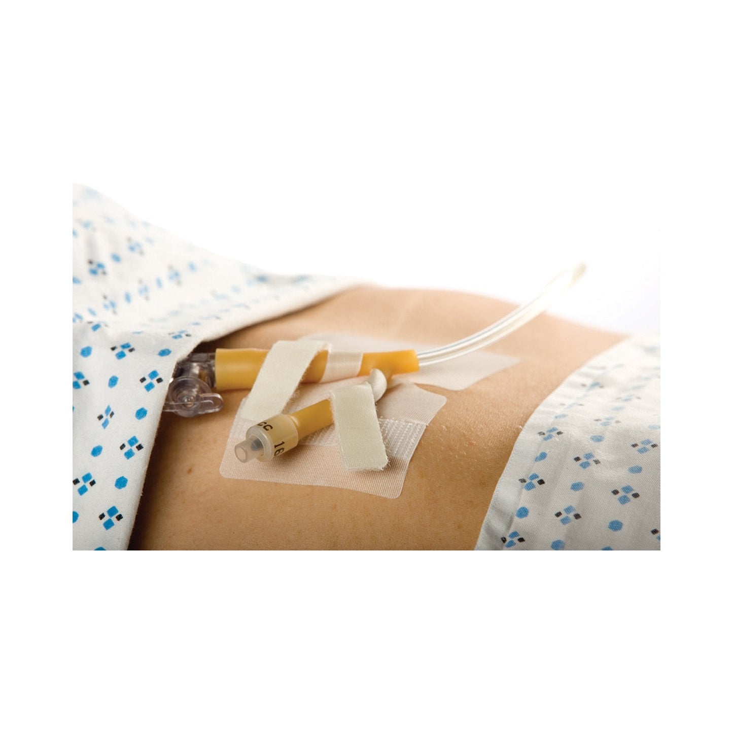 Catheter Holder Cath-Secure Dual Tab® 3 Inch Wrap Tabs x 3 Inch Wide Base - 5445-4
