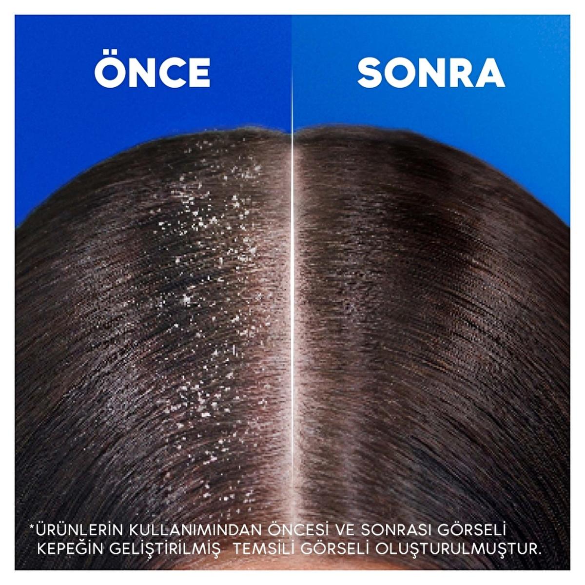 Head & Shoulders Anti-Dandruff Shampoo - Dermatologically Tested, 11.16 fl oz - Anti-Dandruff Relief & Eco-Friendly Packaging