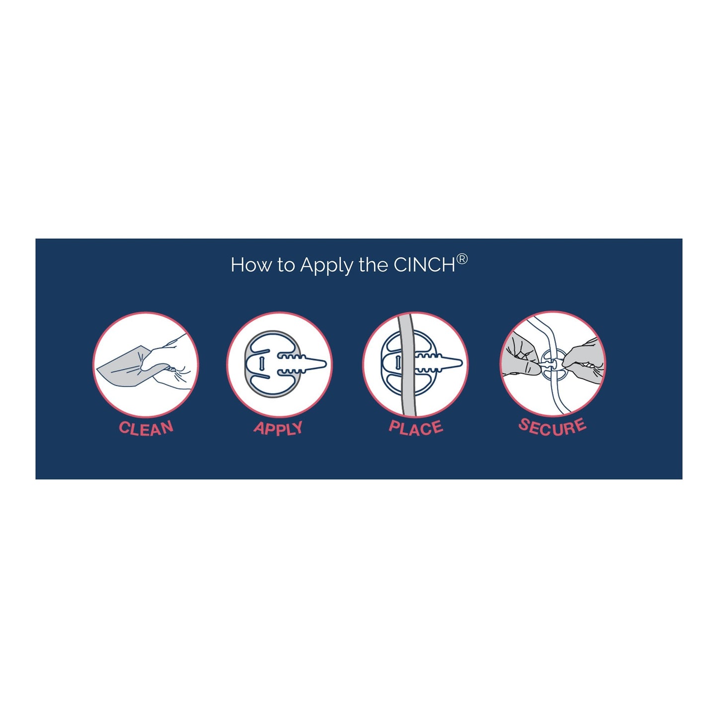 Cinch® Tube Securement Device, Medium CINCH417M-10